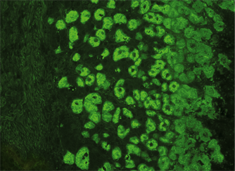 Monkey stomach: Aab against parietal cells